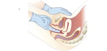 esame dei genitali femminili