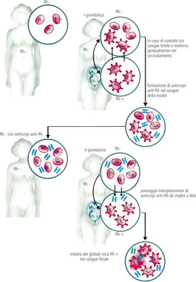 Isoimmunizzazione: Definizione E Significato Medico | Corriere Salute