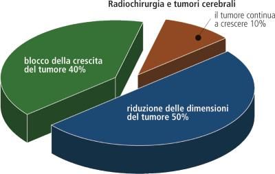 Radiochirurgia: Definizione E Significato Medico | Corriere Salute